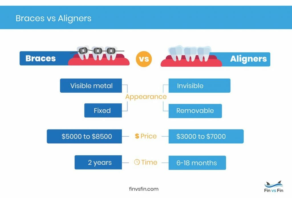 clear aligners vs braces - which is better