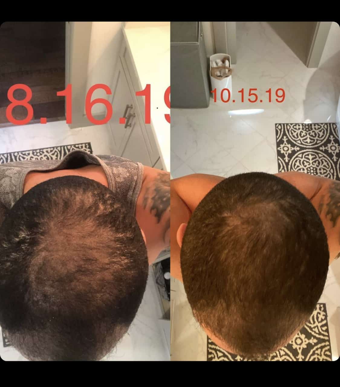 30 Keeps Reviews To Help You Decide If Their Hair Loss Treatment Actually Works