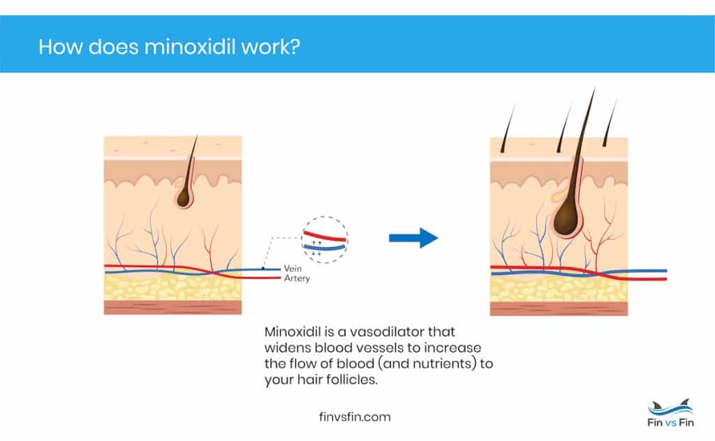 how rogaine and minoxidil work