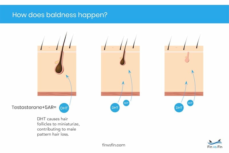 Finasteride Results: How Effective is it for Men’s Hair Loss?