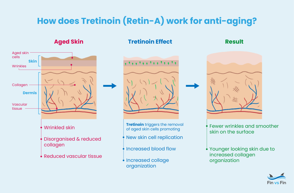 how does tretinoin work for anti-aging