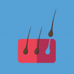 Hair loss section visual with thinning hair reference