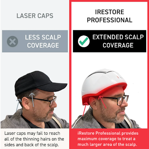 Top 5 Laser Caps in 2026: iRestore vs Hairmax vs Kiierr vs Theradome vs Capillus