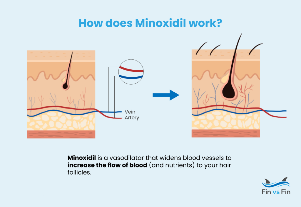 how-does-minoxidil-work