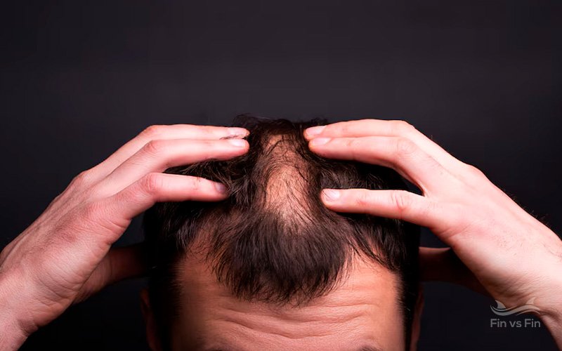 Collagen vs. Biotin vs. Keratin: Understanding the Differences for Hair Loss and Regrowth