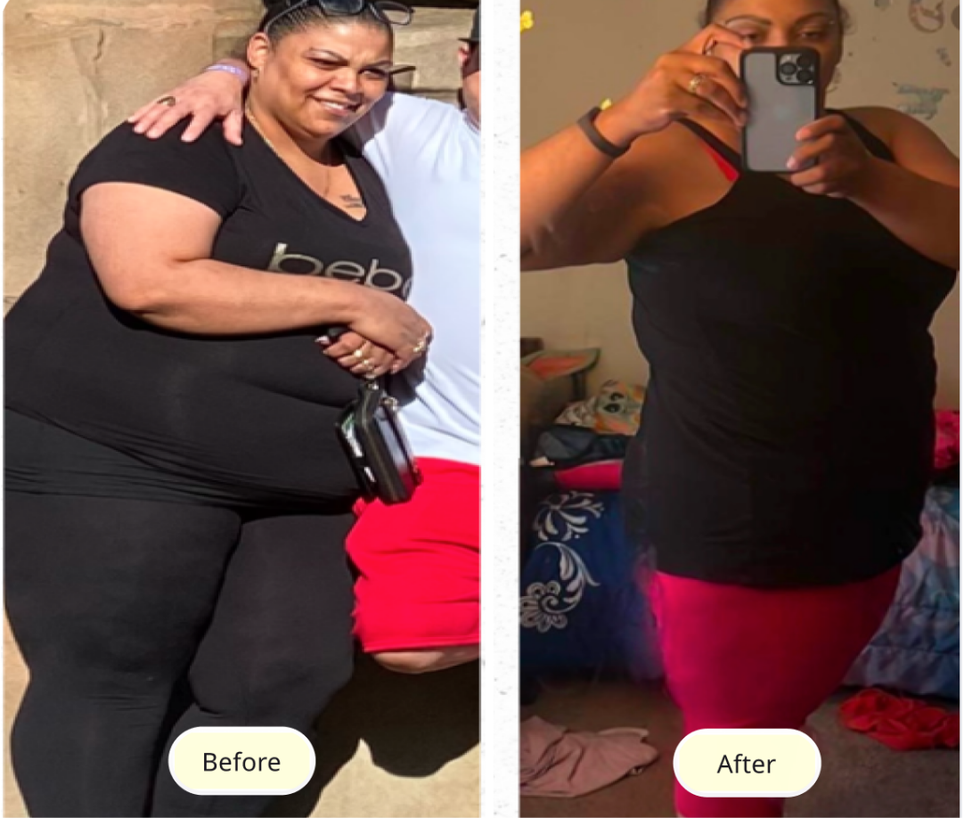5 Myths About Ozempic That Have Kept Millions Away From Effective Weight Loss: Debunked
