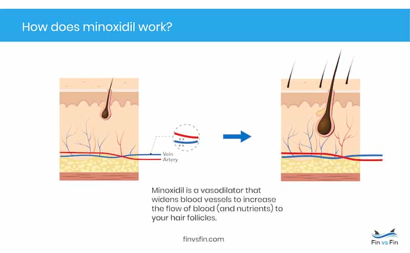 how minoxidil works for hair loss